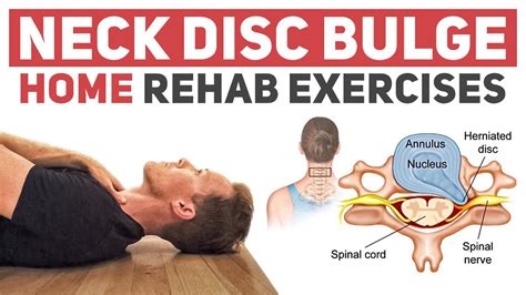 16 Exercises for Herniated Disc (Back or Neck Pain) .